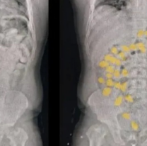 Operativo: se pusieron nerviosos en un control y descubrieron que eran "mulas"