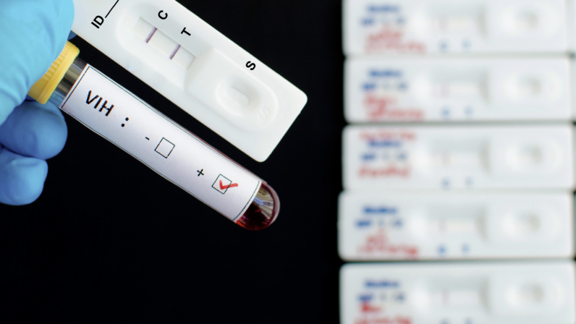 3 de cada 10 personas tienen VIH en Jujuy, la tasa más alta del país