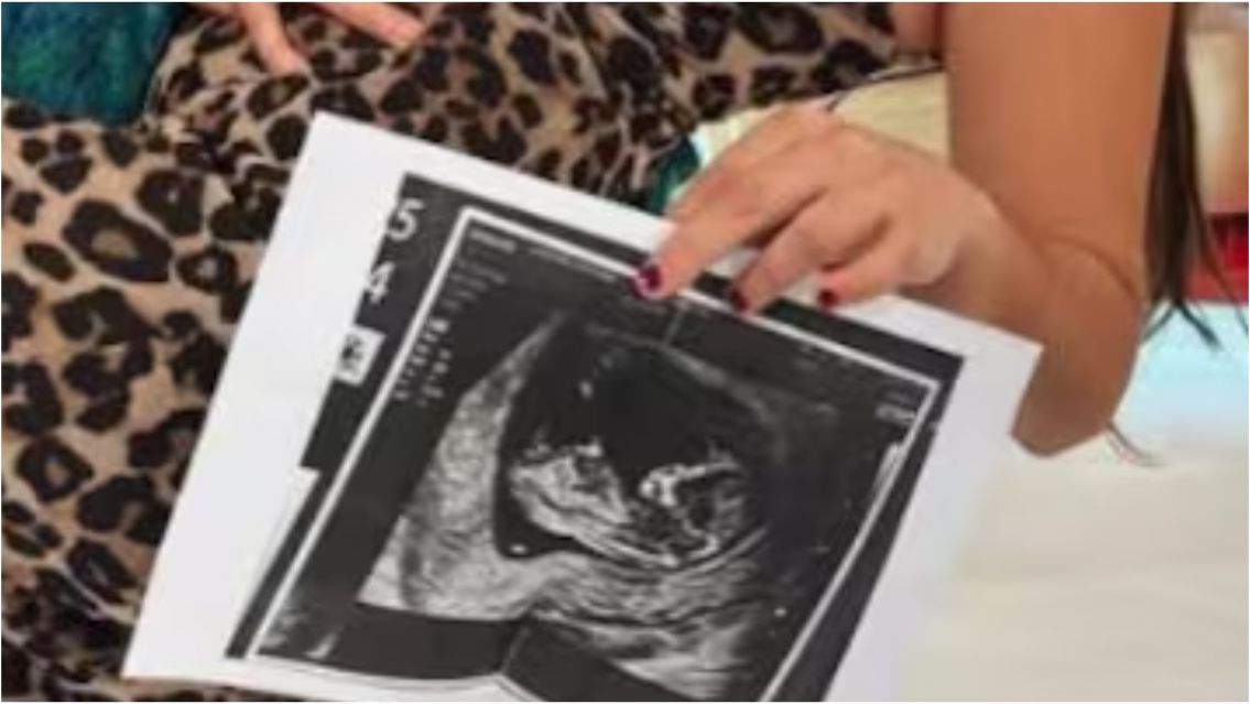 Una ex Gran Hermano anunció que está embarazada: mirá quién es el padre