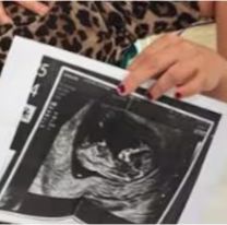 Una ex Gran Hermano anunció que está embarazada: mirá quién es el padre