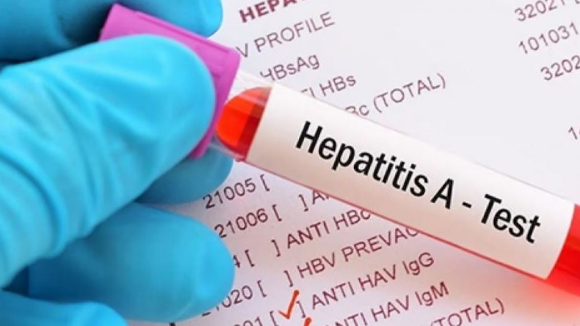 Alerta por un brote de hepatitis A en  Jujuy y otras 12 provincias: cu�ntos casos se registraron