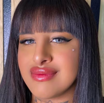 Nueva operación de "La Coqueta": "No tengo miedo", dijo la influencer