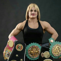 "Todo sea por salvarla": porqué operaron a la Locomotora Oliveras