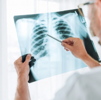 Tuberculosis en Jujuy: confirman pocos casos y explican el protocolo en escuelas