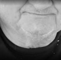 [QEPD] La muerte que golpea a un reconocido jugador de f&uacute;tbol: "Le..."