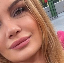 La deformación en la cara que sufrió Eliana Guercio