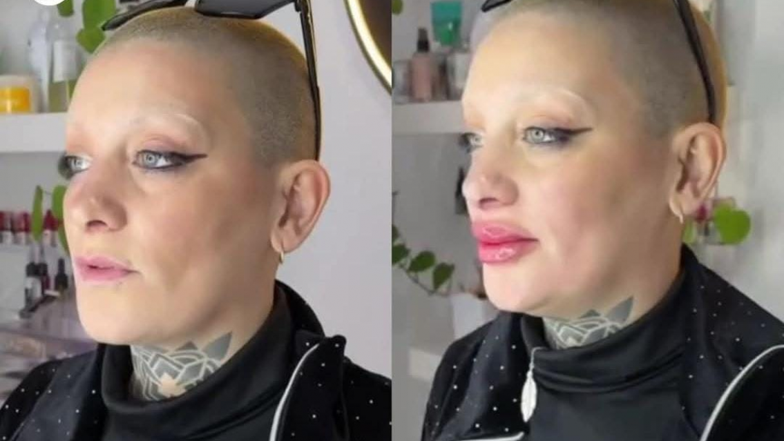 Cómo quedó Furia de Gran Hermano tras su retoque en la cara