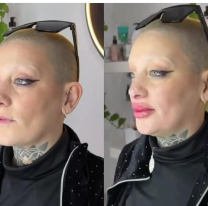 Cómo quedó Furia de Gran Hermano tras su retoque en la cara