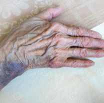 Delincuentes ataron a una abuelita jujeña a una mesa para desvalijar su casa