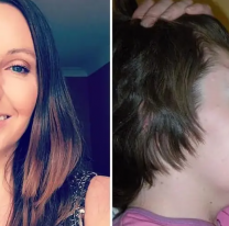 Mujer perdió la frente en accidente por viajar con los pies sobre el tablero