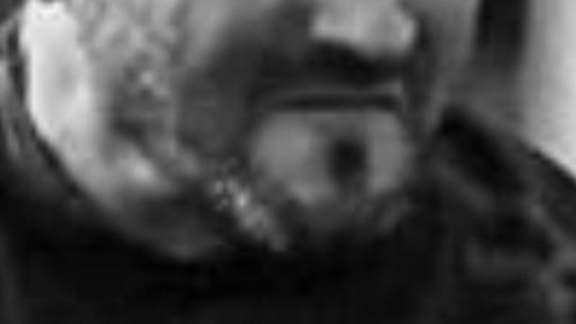 [QEPD] Muri� un reconocido rugbier en pleno partido: ten�a 41 a�os