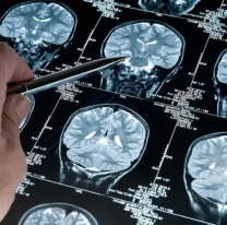 Gran avance sobre el Alzheimer: de la mano de cient&iacute;ficos argentinos
