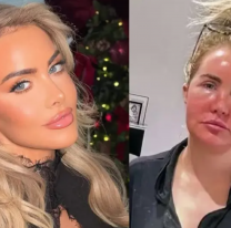 Se hizo una cirugía estética y en el quirófano encontraron algo asqueroso dentro de su cara