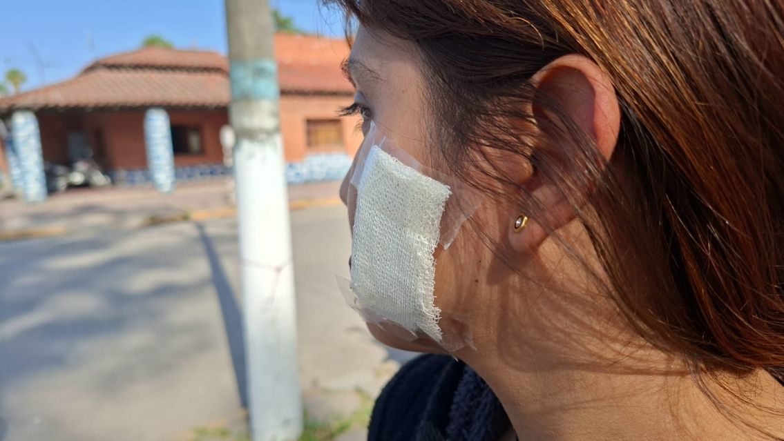 Juje�a corri� a un chorro con un palo pero termin� gravemente herida