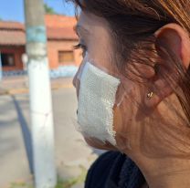 Jujeña corrió a un chorro con un palo pero terminó gravemente herida