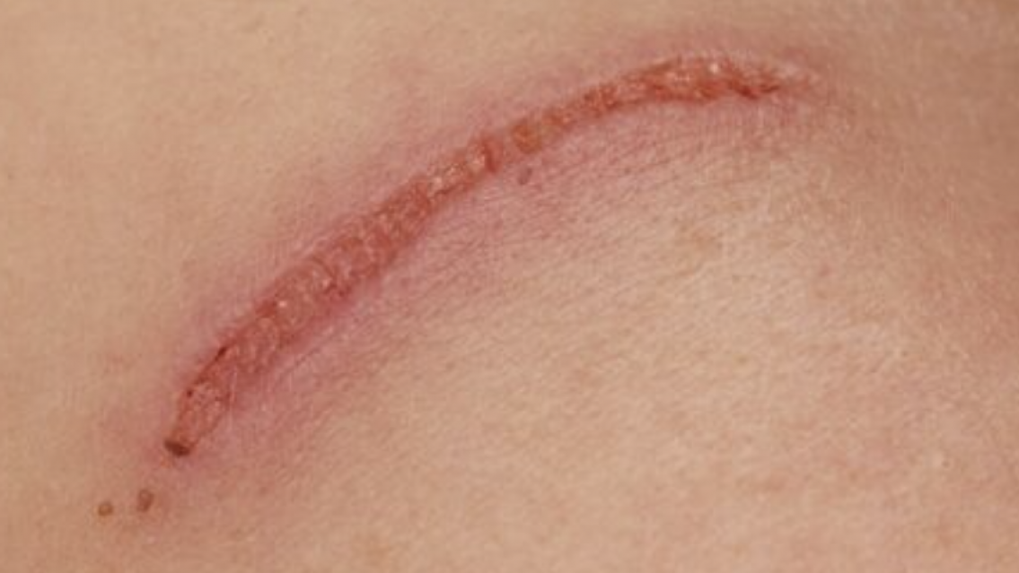 Juje�a sacada atac� a ara�azos a polic�as en San Pedrito