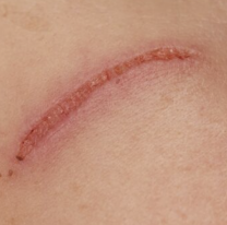 Jujeña sacada atacó a arañazos a policías en San Pedrito