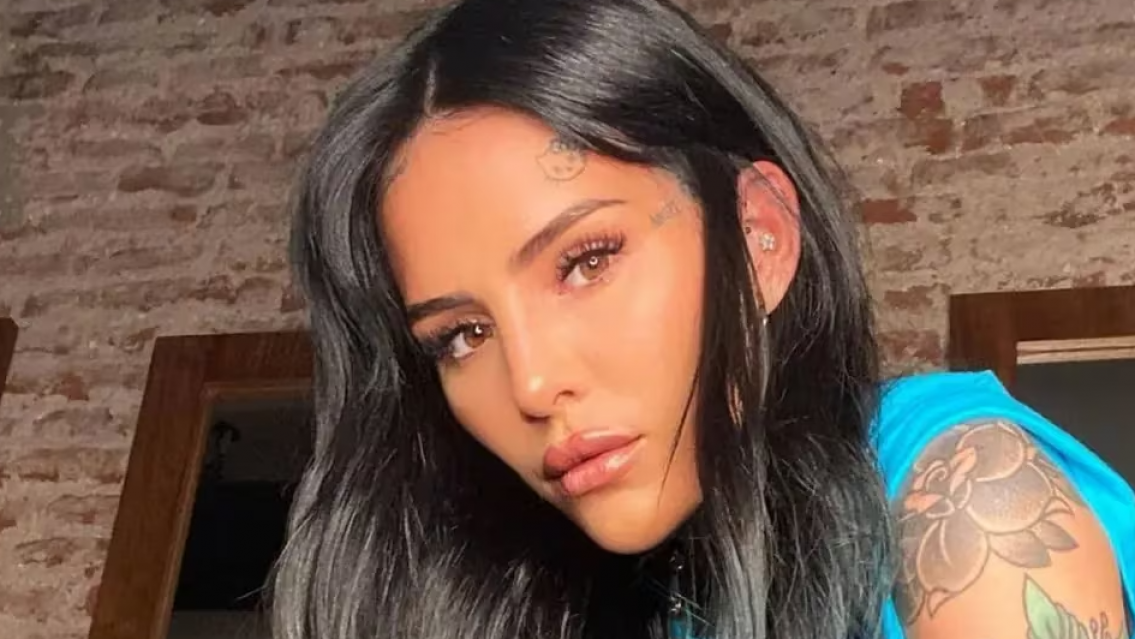 Operan de urgencia a Cande Tinelli: sufri� un terrible accidente en plena grabaci�n