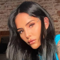 Operan de urgencia a Cande Tinelli: sufrió un terrible accidente en plena grabación