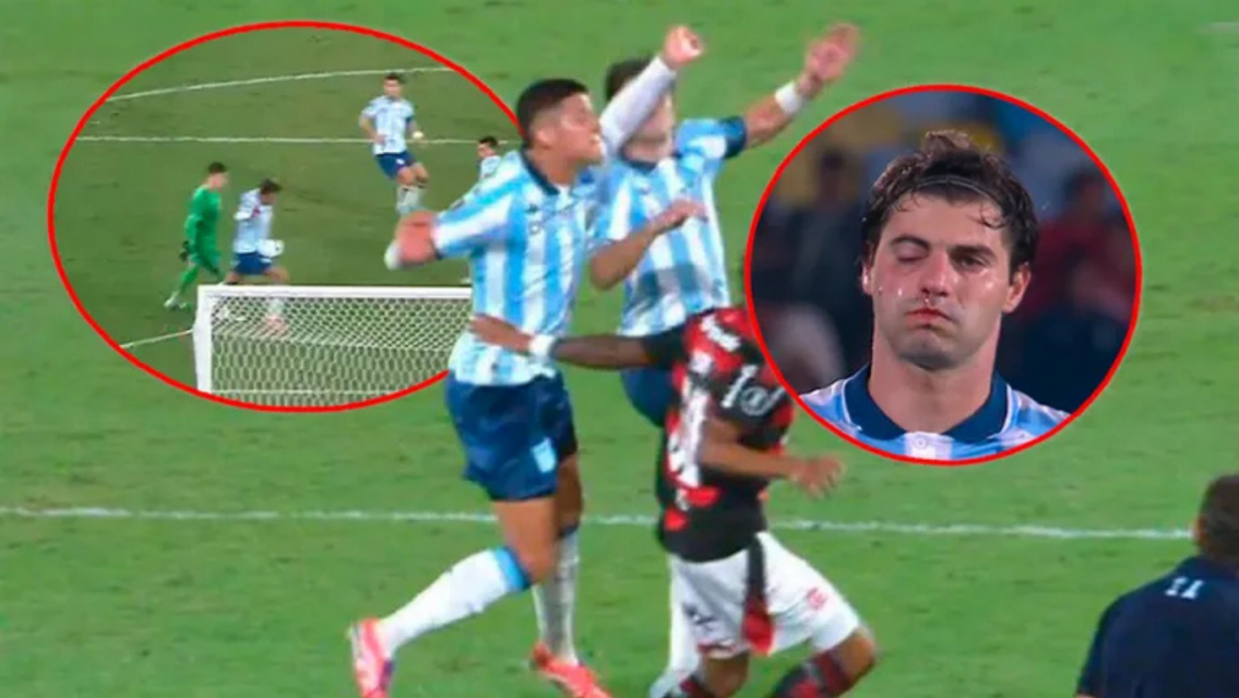 Marcos Rojo desfigur� a Sosa y se pierde el partido de vuelta: est� fracturado