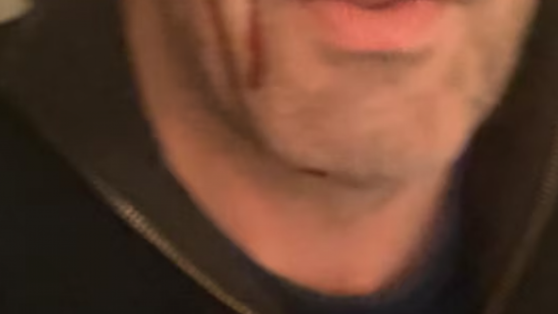 Conmoci�n a horas de las elecciones: asaltaron y golpearon a un candidato