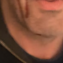 Conmoci&oacute;n a horas de las elecciones: asaltaron y golpearon a un candidato