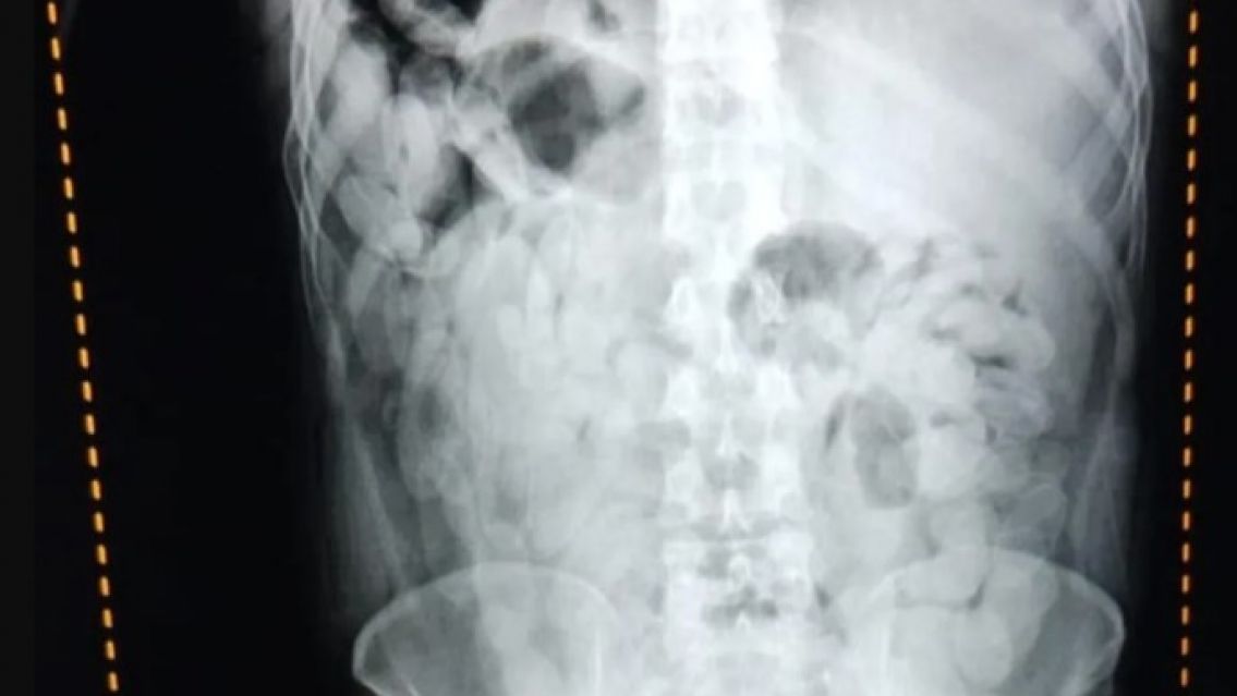 "Nos duele mucho la panza": salieron de Jujuy y lo que se tragaron los dej� en el peor estado