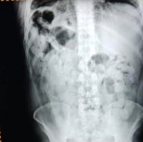 "Nos duele mucho la panza": salieron de Jujuy y lo que se tragaron los dejó en el peor estado