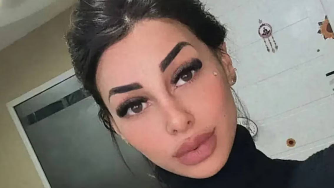 C�mo qued� Tamara B�ez tras su nueva cirug�a: "No lo puedo creer"