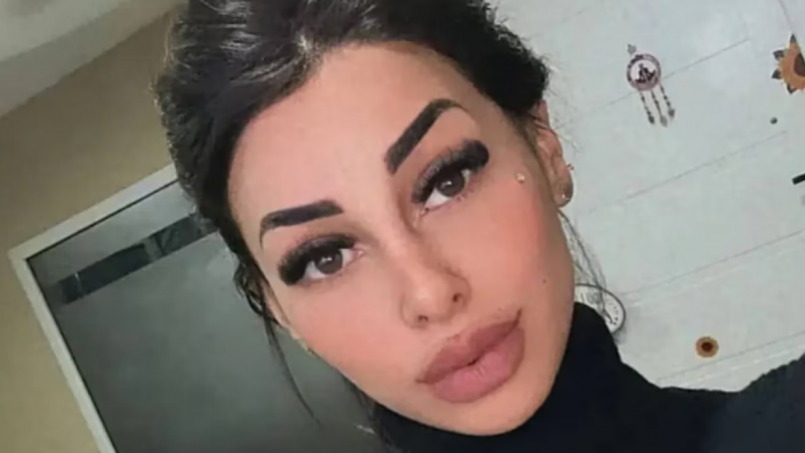 "No lo puedo creer": así quedó la ex de L-Gante tras su retoque estético