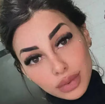 "No lo puedo creer": así quedó la ex de L-Gante tras su retoque estético