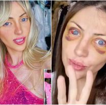 Conmoción por la muerte de una influencer que se transformó en "Barbie humana"