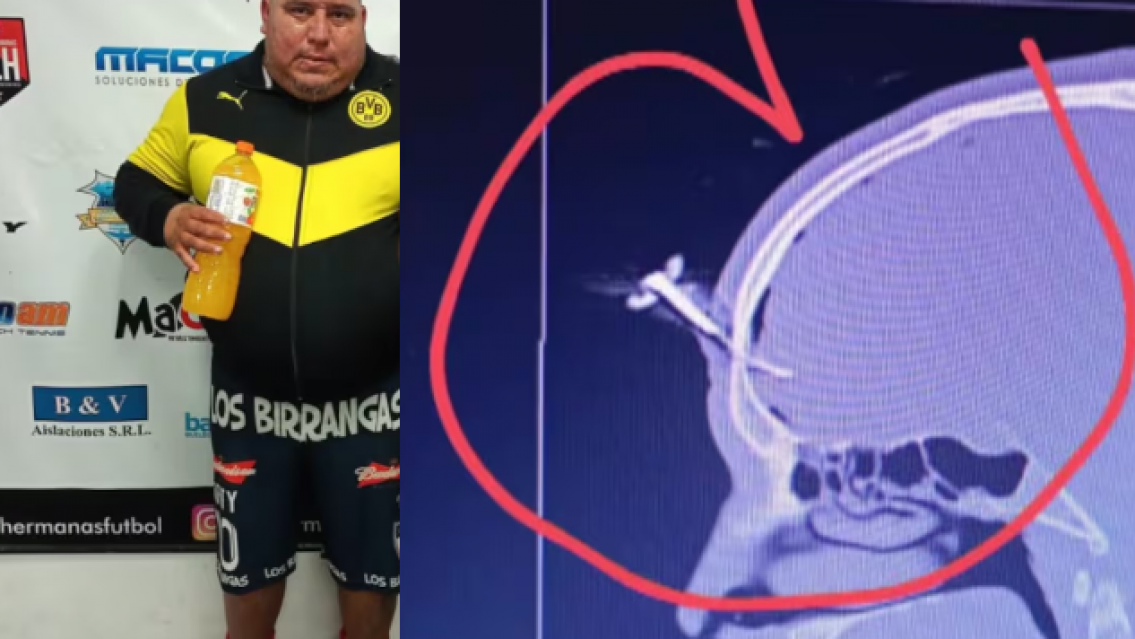 Antecedentes de violencia: le clav� una llave a un hombre en un partidito de chicos