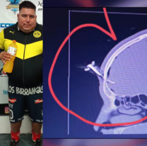 Antecedentes de violencia: le clavó una llave a un hombre en un partidito de chicos