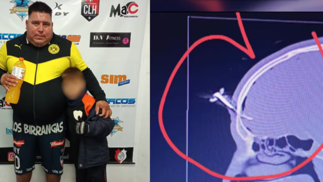 El desafiante posteo del padre que le clavó a otro una llave durante un partido de chicos