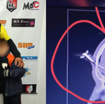 El desafiante posteo del padre que le clavó a otro una llave durante un partido de chicos