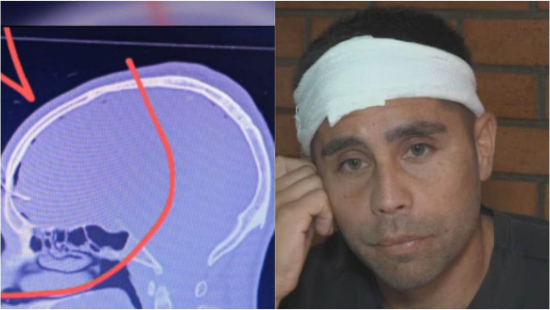 Exfutbolista atacado brutalmente en un partido: termin� con una llave en la cabeza