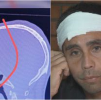 Exfutbolista atacado brutalmente en un partido: terminó con una llave en la cabeza