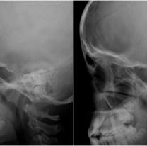 Le dolía el ojo y encontraron algo inesperado en su cabeza: los médicos no lo creían
