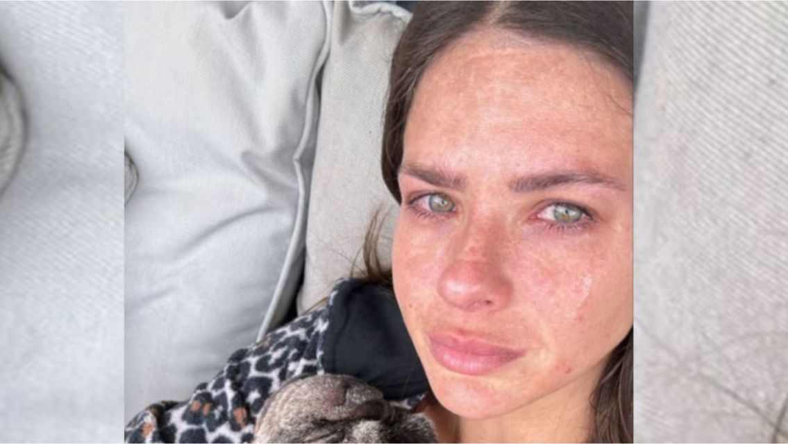 Se accidentó la China Suárez y no pudo aguantar el dolor: "Me rompí..."