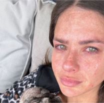 Se accidentó la China Suárez y no pudo aguantar el dolor: "Me rompí..."