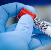 La sífilis alcanza cifras récord en Argentina: hay 181 casos en Jujuy