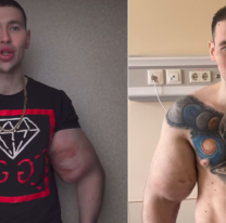 Se puso vaselina en los bíceps para parecerse a "Popeye"