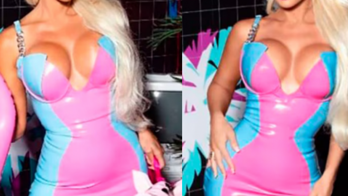 Grasa de cadáver y sangre de su hijo, el tratamiento extremo de la Barbie argentina