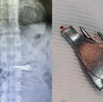 Un preso de alto perfil se tragó un tenedor en la cárcel