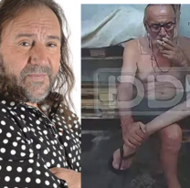 Preocupa el estado del humorista "Cacho" Garay, le sacaron los dedos del pie