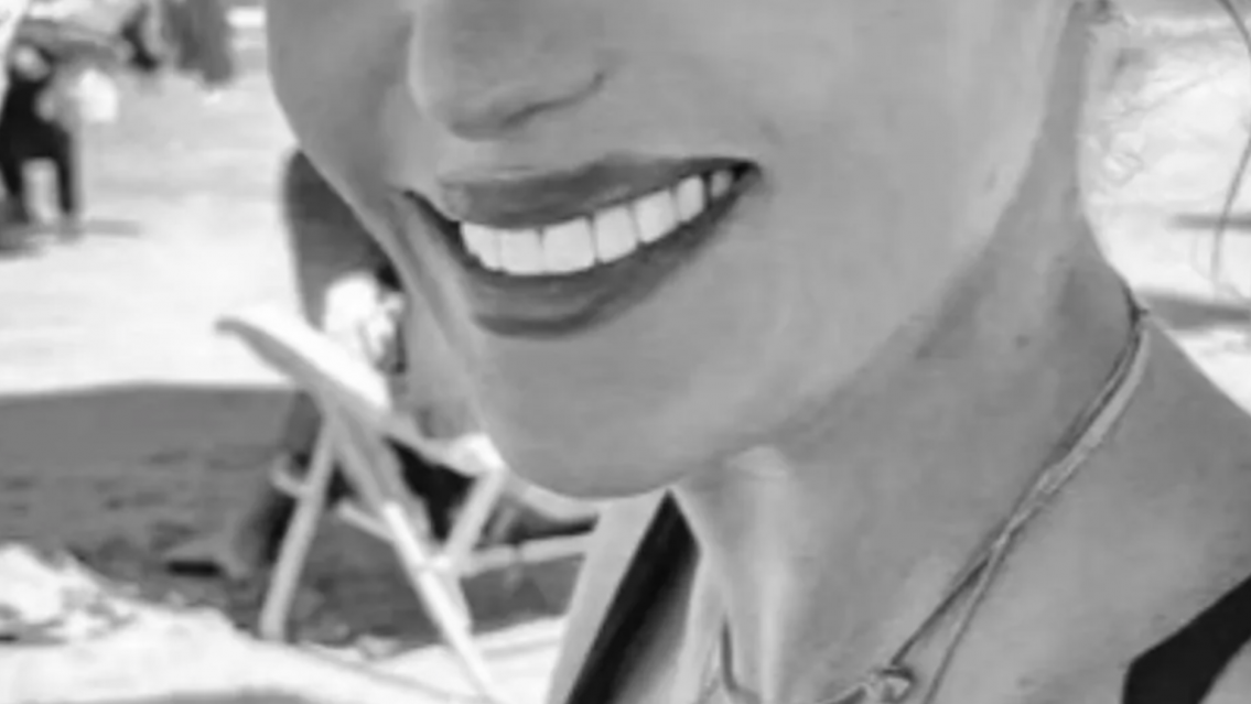 [TERRIBLE] Muri� la "Barbie" brasile�a: el escalofriante motivo