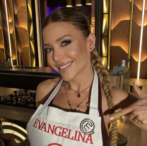 No es el col&aacute;geno de su novio: el tratamiento de Evangelina Anderson para rejuvenecer