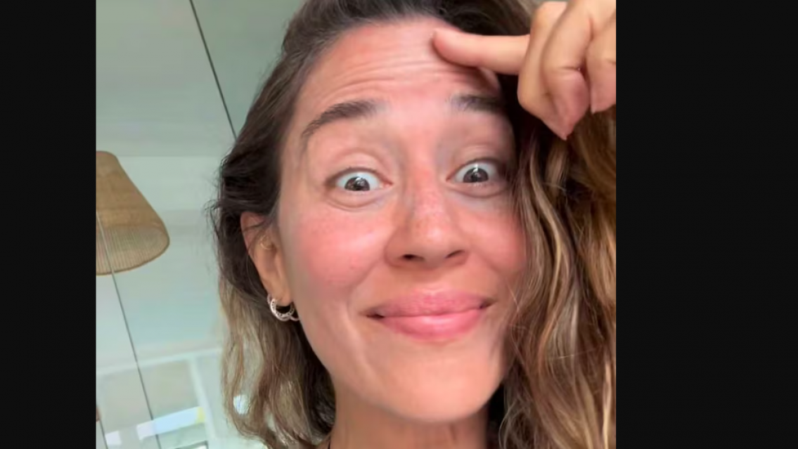 Jimena Barón impactó al revelar cómo luce tras 20 meses sin botox