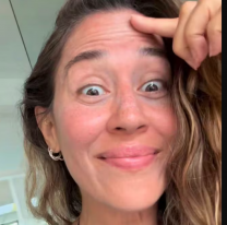 Jimena Barón impactó al revelar cómo luce tras 20 meses sin botox